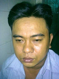 Tuấn mập - kẻ chuyên xách giỏ ở công viên ảnh 1