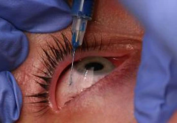 Rùng mình với dịch vụ làm đẹp mới: Xăm cầu mắt ảnh 1