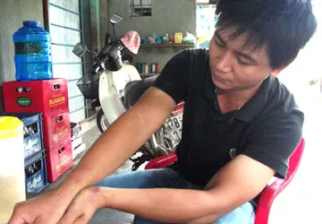 Khỉ tấn công, hơn 10 người bị thương ảnh 1 Khỉ tấn công, hơn 10 người bị thương ảnh 1