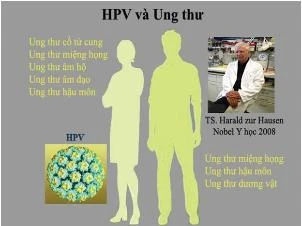 Mỹ: Gia tăng ung thư vòm họng vì làm tình bằng miệng* ảnh 1