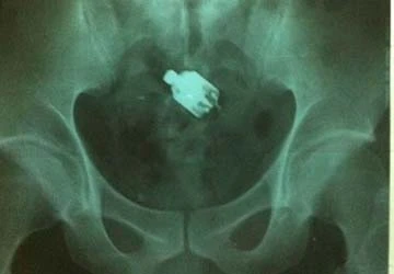 Hết hồn vì đồ chơi tình dục ảnh 1