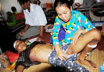 Vụ em trai 14 tuổi bị hành hạ dã man ở Cà Mau: Chủ trại tôm quá độc ác! ảnh 3 Vụ em trai 14 tuổi bị hành hạ dã man ở Cà Mau: Chủ trại tôm quá độc ác! ảnh 3