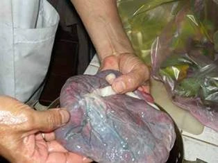Nhau thai khô bán nhan nhản trên thị trường ảnh 1 Nhau thai khô bán nhan nhản trên thị trường ảnh 1