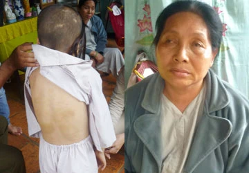 Vụ bắt trẻ quỳ trên vỏ sầu riêng: Bé Ngân bị hành hạ nhiều năm ảnh 1