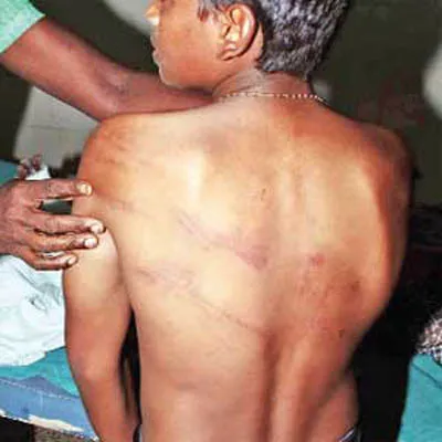 Nam sinh tố bị 3 giáo viên ép uống nước tiểu ảnh 1