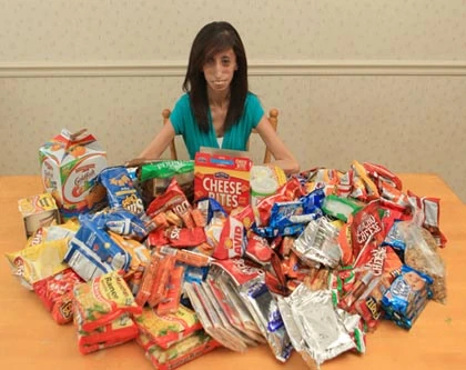 Cô gái "xấu xí nhất thế giới" mơ làm diễn giả ảnh 5