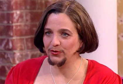 Chuyện lạ: Phụ nữ mọc râu như đàn ông ảnh 1