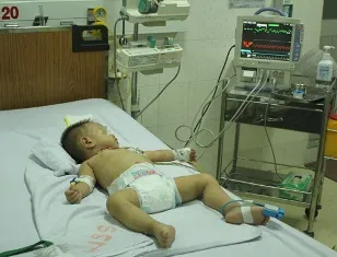 Viêm họng, coi chừng nhiễm não mô cầu ảnh 1