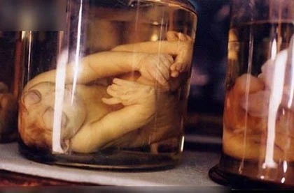 Bảo tàng rùng rợn nhất thế giới ảnh 3