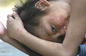 Cậu bé lạ kỳ ảnh 1