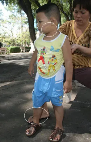 Người tâm thần hành hạ dã man cháu bé 3 tuổi ảnh 1 Người tâm thần hành hạ dã man cháu bé 3 tuổi ảnh 1