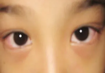 Kawasaki: Kẻ đội lốt nguy hiểm ảnh 1