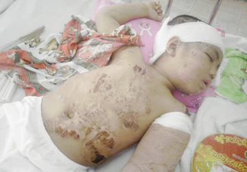 Trẻ 4 tuổi suýt chết vì bị cô giáo nhốt trong thang máy ảnh 1