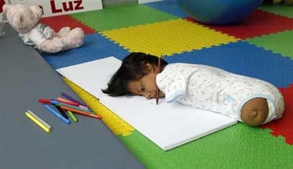 Nghị lực của bé gái không tay, không chân ảnh 3