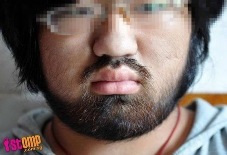 Uống thuốc mạnh, thiếu nữ mọc đầy râu, lông ảnh 1