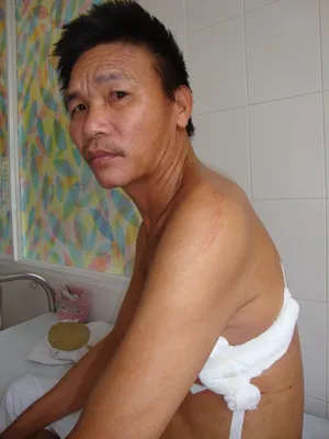 Một công an xã đánh người gãy năm xương sườn ảnh 1 Một công an xã đánh người gãy năm xương sườn ảnh 1