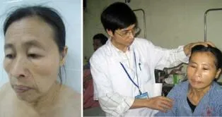 Thêm trường hợp “già trước tuổi” ảnh 1