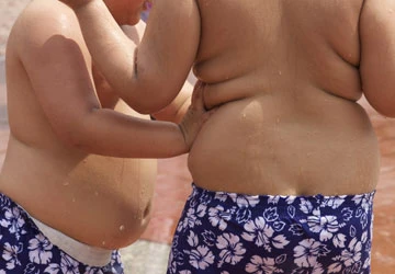 Trẻ béo phì có nguy cơ mắc chứng đa xơ cứng ảnh 1