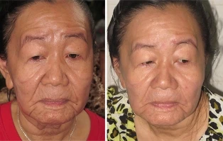 Nét mặt chị Phượng đã có dấu hiệu cải thiện ảnh 1