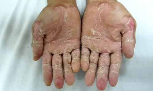 Bệnh lạ do nhiễm độc từ môi trường? ảnh 1 Bệnh lạ do nhiễm độc từ môi trường? ảnh 1