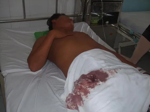 Công an xã bắn thủng bụng một thanh niên ảnh 1 Công an xã bắn thủng bụng một thanh niên ảnh 1