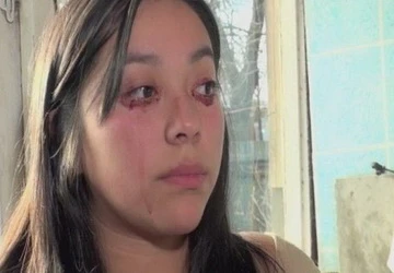 Thiếu nữ khóc ra máu ảnh 1