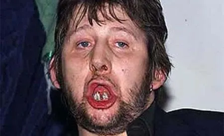 Điểm mặt những người nổi tiếng xấu nhất thế giới ảnh 8 Điểm mặt những người nổi tiếng xấu nhất thế giới ảnh 8