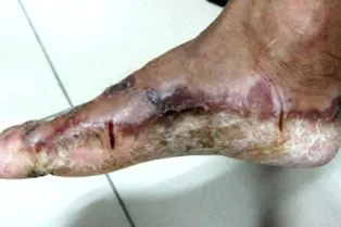 Bệnh lạ do nhiễm độc từ môi trường? ảnh 2 Bệnh lạ do nhiễm độc từ môi trường? ảnh 2