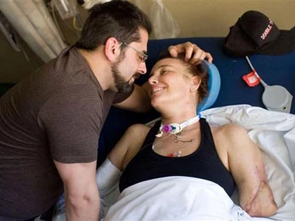 Ghép tay sau khi bị vi khuẩn ăn thịt người "gặm" cụt ảnh 1