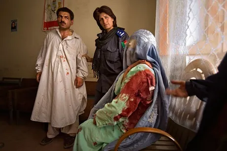 Những hình ảnh khó tin về nạn tảo hôn ảnh 6