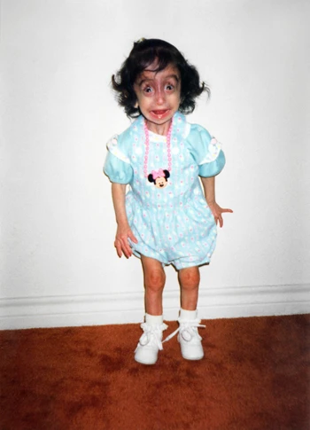 Cô gái "xấu xí nhất thế giới" mơ làm diễn giả ảnh 3