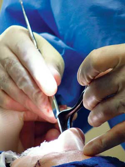 Gọt hàm, độn cằm: hành xác để đẹp ảnh 1