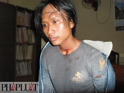 Chùm ảnh: Hiện trường vụ bắt cóc học sinh trường mầm non ảnh 25