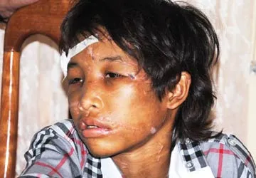 Vụ hành hạ trẻ em dã man ở Cà Mau: Có thể xử Giang-Thơm ở khung cao nhất ảnh 1 Vụ hành hạ trẻ em dã man ở Cà Mau: Có thể xử Giang-Thơm ở khung cao nhất ảnh 1