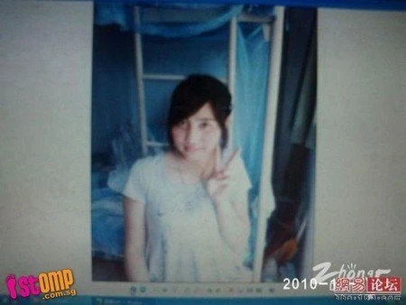 Uống thuốc mạnh, thiếu nữ mọc đầy râu, lông ảnh 2