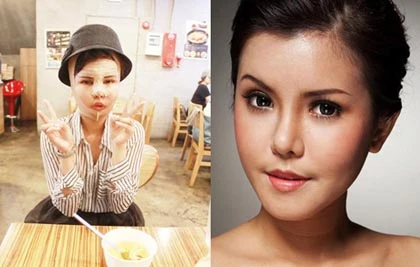 Sự thật ở thẩm mỹ viện "siêu tốc và không đau" ảnh 1