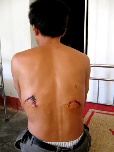 Thú lạ tấn công người đi rừng là đười ươi ảnh 1