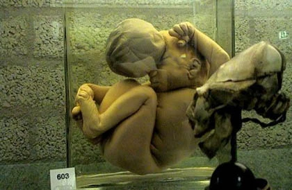 Bảo tàng rùng rợn nhất thế giới ảnh 10