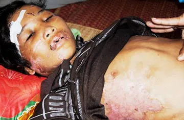 Bé Hào Anh bị bẻ răng, cắt môi: "Cuộc chơi hả hê" của vợ chồng Giang - Thơm? ảnh 1 Bé Hào Anh bị bẻ răng, cắt môi: "Cuộc chơi hả hê" của vợ chồng Giang - Thơm? ảnh 1