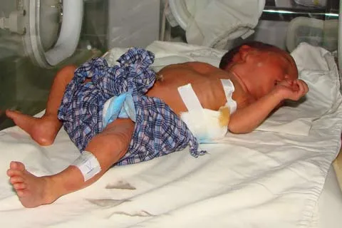 TT – Huế: Cứu sống thai nhi từ sản phụ đã chết ảnh 1