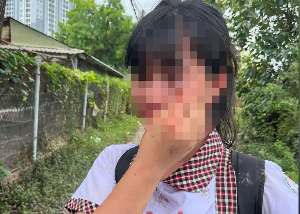 cong-an-lam-viec-voi-nhom-hoc-sinh-danh-hoi-dong-ban-hoc-o-thu-duc (2).jpg