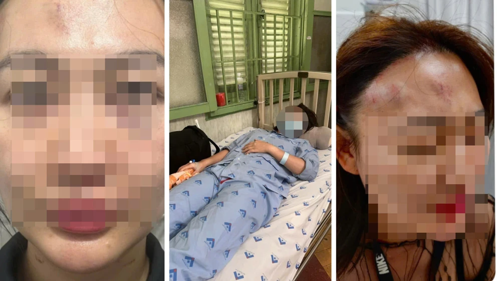 Cô gái bị bạn trai đánh gục tại quán cà phê vì tố anh này yêu cùng lúc nhiều người. Ảnh: HT Cô gái bị bạn trai đánh gục tại quán cà phê vì bị tố chuyện yêu nhiều người cùng lúc