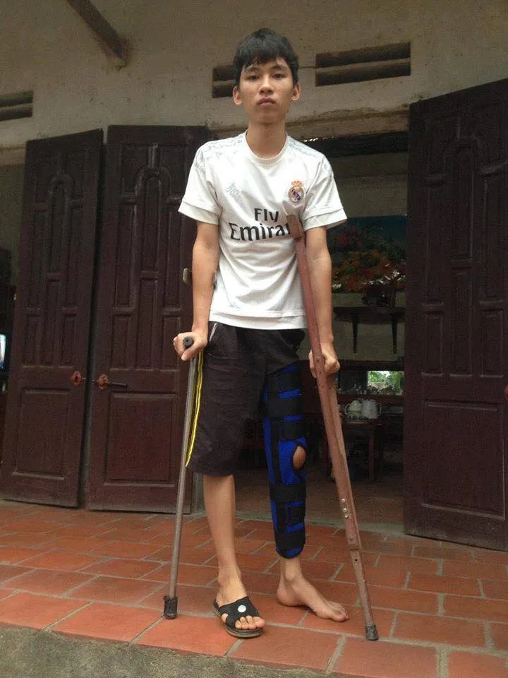 “Em muốn có đôi chân khỏe mạnh để được đến trường” ảnh 4 “Em muốn có đôi chân khỏe mạnh để được đến trường” ảnh 4