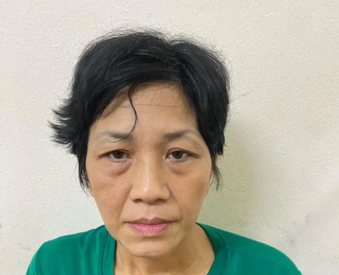 Chân dung Chu Thị Thi. Ảnh CA benh-vien-viet-duc.jpg