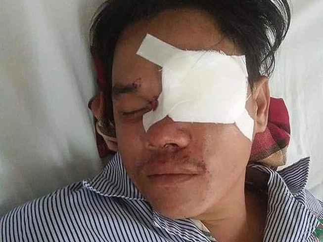 'Tín dụng đen' đâm mù mắt người vay nợ không có tiền trả