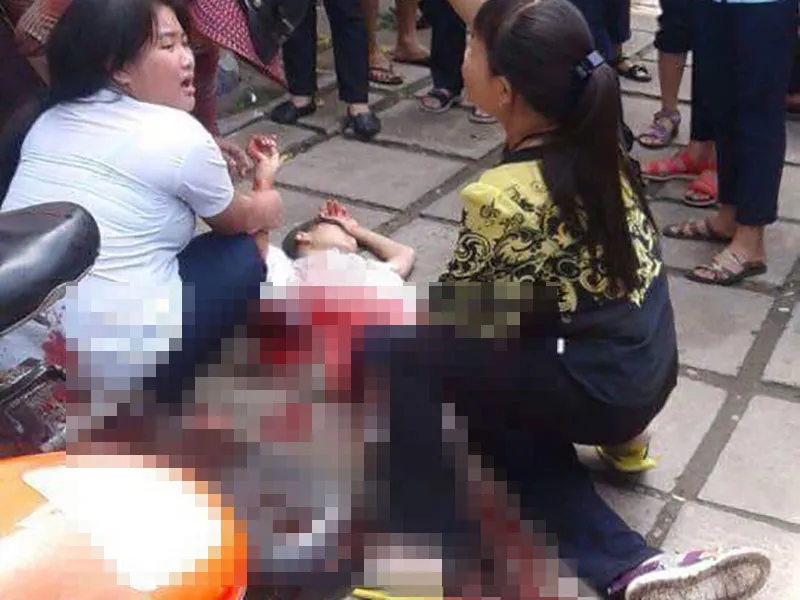 Xô xát nhau, một học sinh làm bị thương hai bạn học ảnh 2 Xô xát nhau, một học sinh làm bị thương hai bạn học ảnh 2