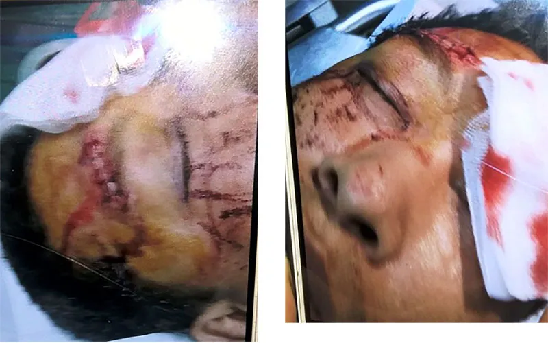 Cả chục người có hung khí tấn công nhà dân ở Gò Vấp ảnh 2