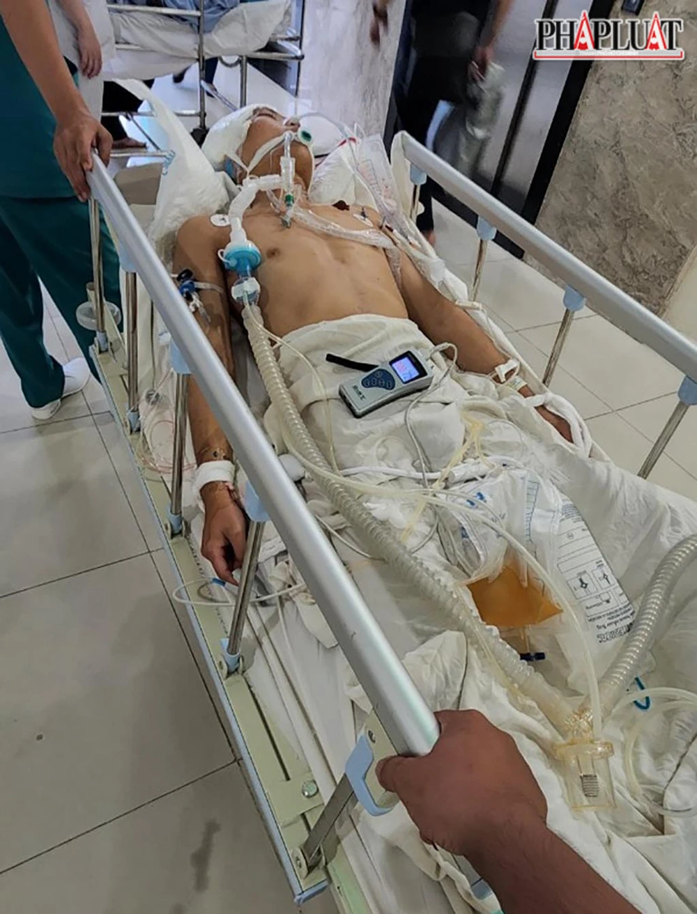 Hiện tại, tình trạng sức khỏe của anh K vẫn chưa có dấu hiệu bình phục. Ảnh: GĐCC