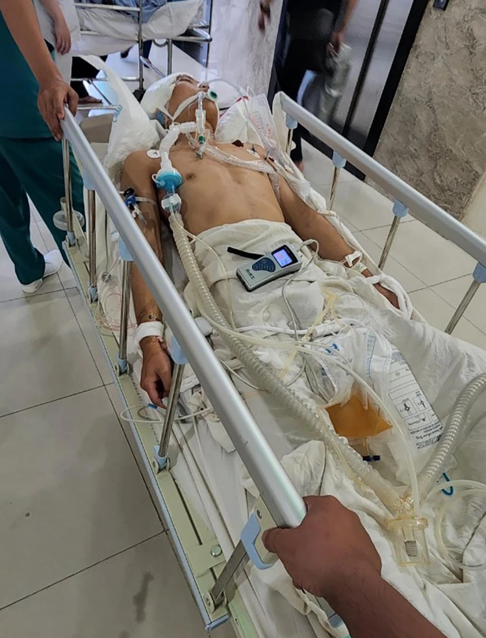 Anh K mặc dù được cứu chữa tích cực nhưng không qua khỏi. Ảnh: GĐCC