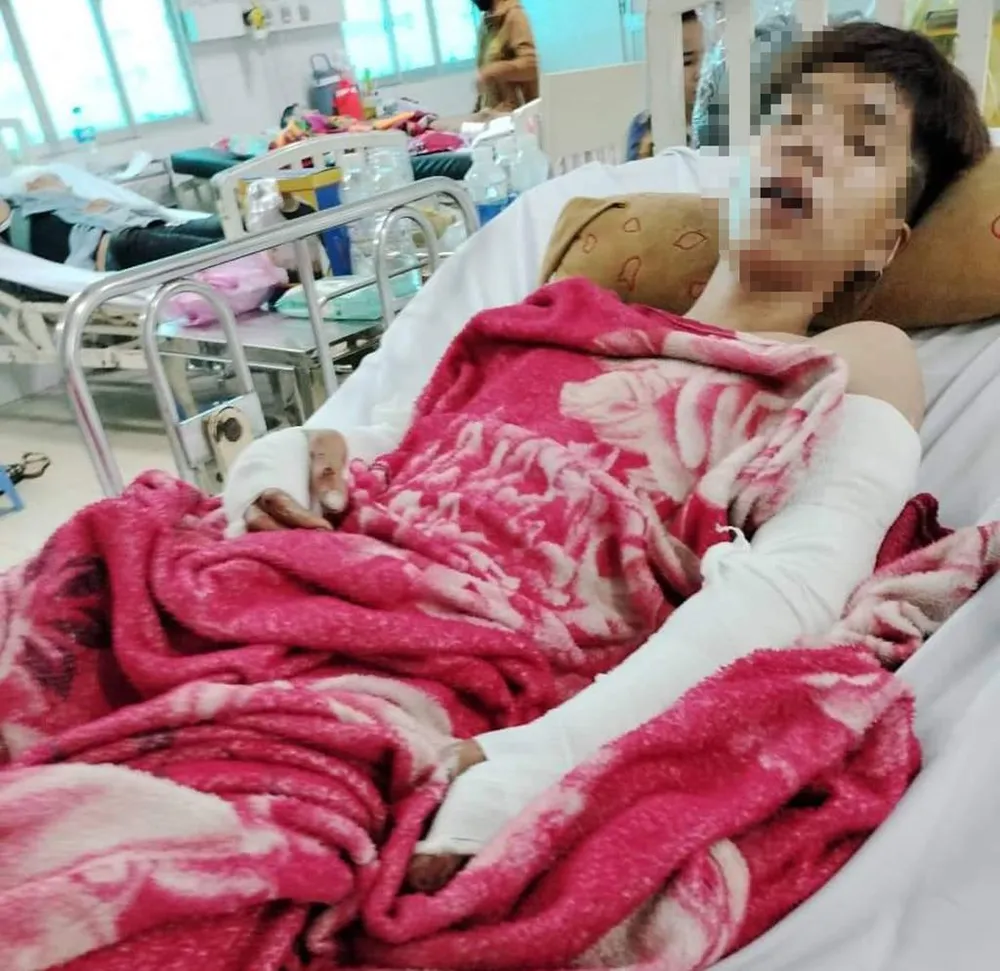 Sau vụ việc, anh H trọng thương, được đưa vào bệnh viện cấp cứu. Ảnh: GĐCC